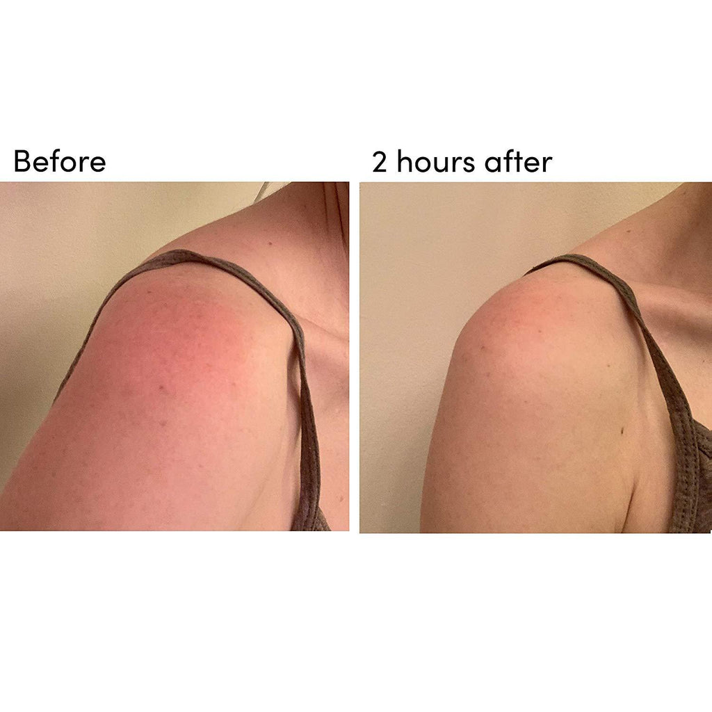 BODY 301: After-Sun Aloe Wipes (Pack of 15)